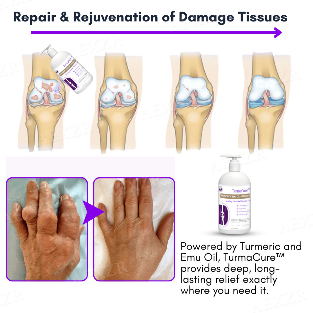 TurmaCure™ Turmeric & Emu Oil Arthritis Soothing Pain Relief Massage Gel