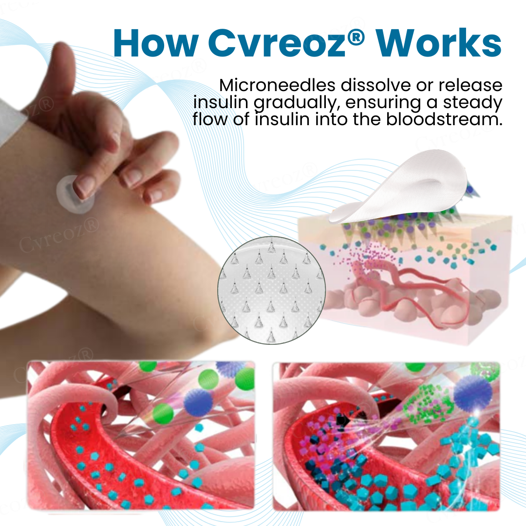 Cvreoz® InsuliNeedle Glucose Control Microneedling Patch