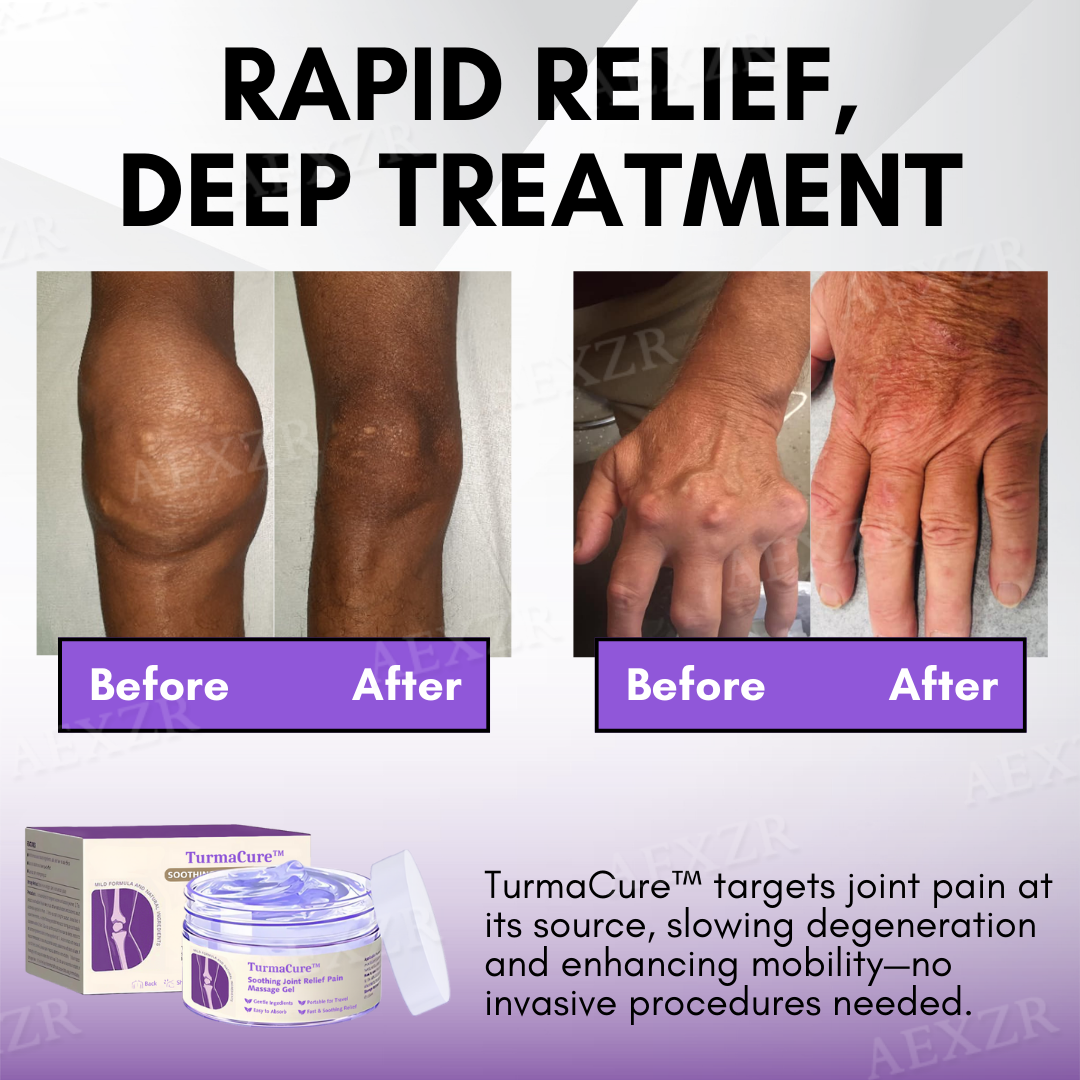 TurmaCure™ Turmeric & Emu Oil Arthritis Soothing Pain Relief Massage Gel (𝑨𝑶𝑨) 𝑨𝒑𝒑𝒓𝒐𝒗𝒆𝒅