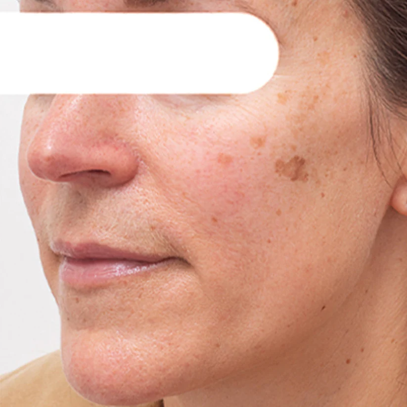 AEXZR® Herbal Spots Peel-Off Facial Mask