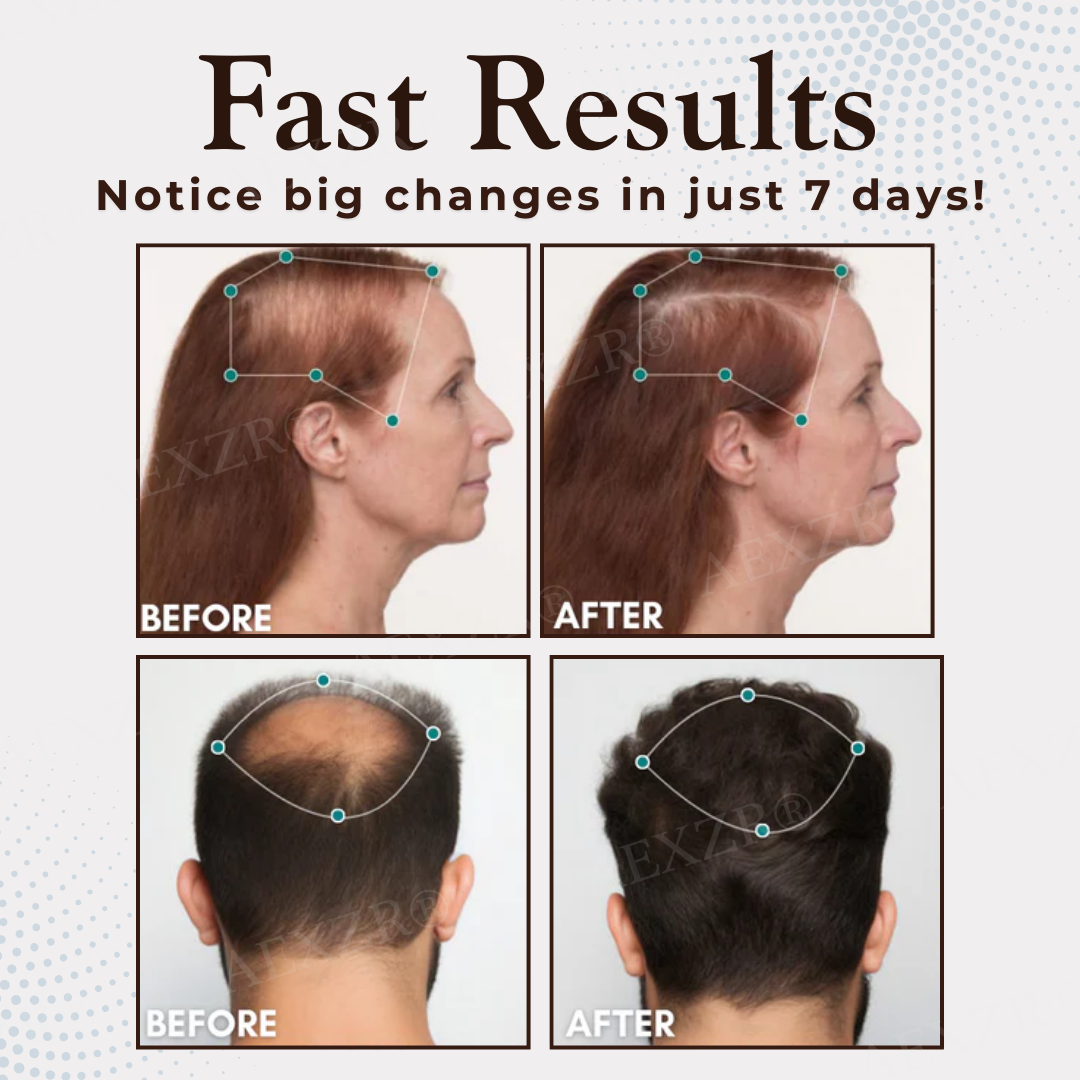 AEXZR® Hair Regrowth Capsules