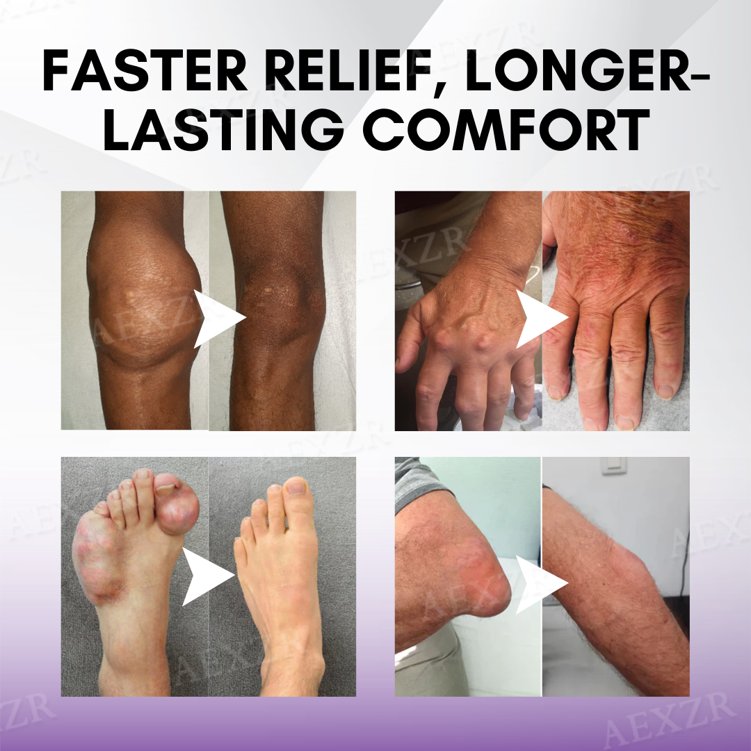 TurmaCure™ Turmeric & Emu Oil Arthritis Soothing Pain Relief Massage Gel