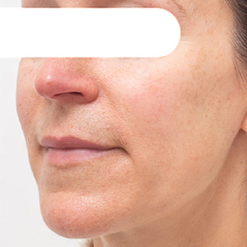AEXZR® Herbal Spots Peel-Off Facial Mask