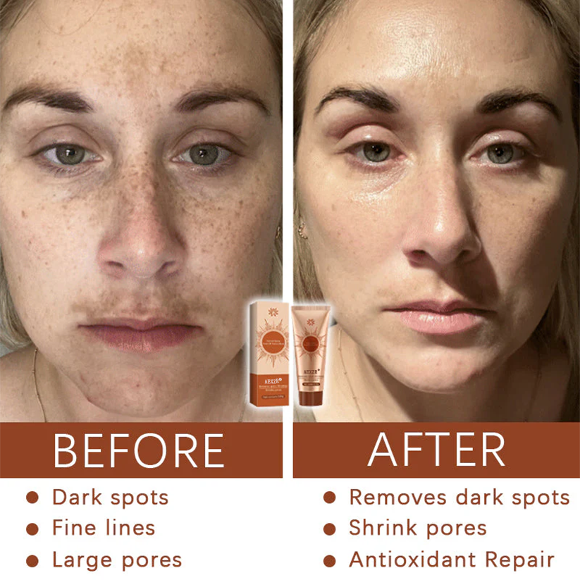 AEXZR® Herbal Spots Peel-Off Facial Mask