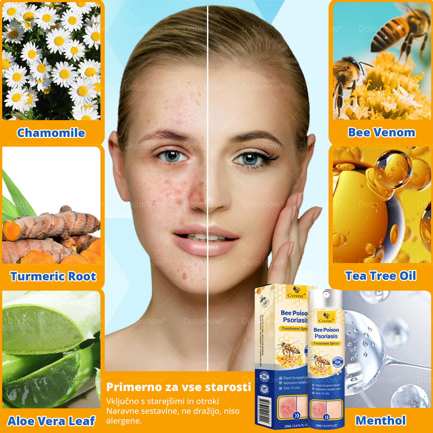Cvreoz® Bee Venom Psoriasis Treatment Spray
