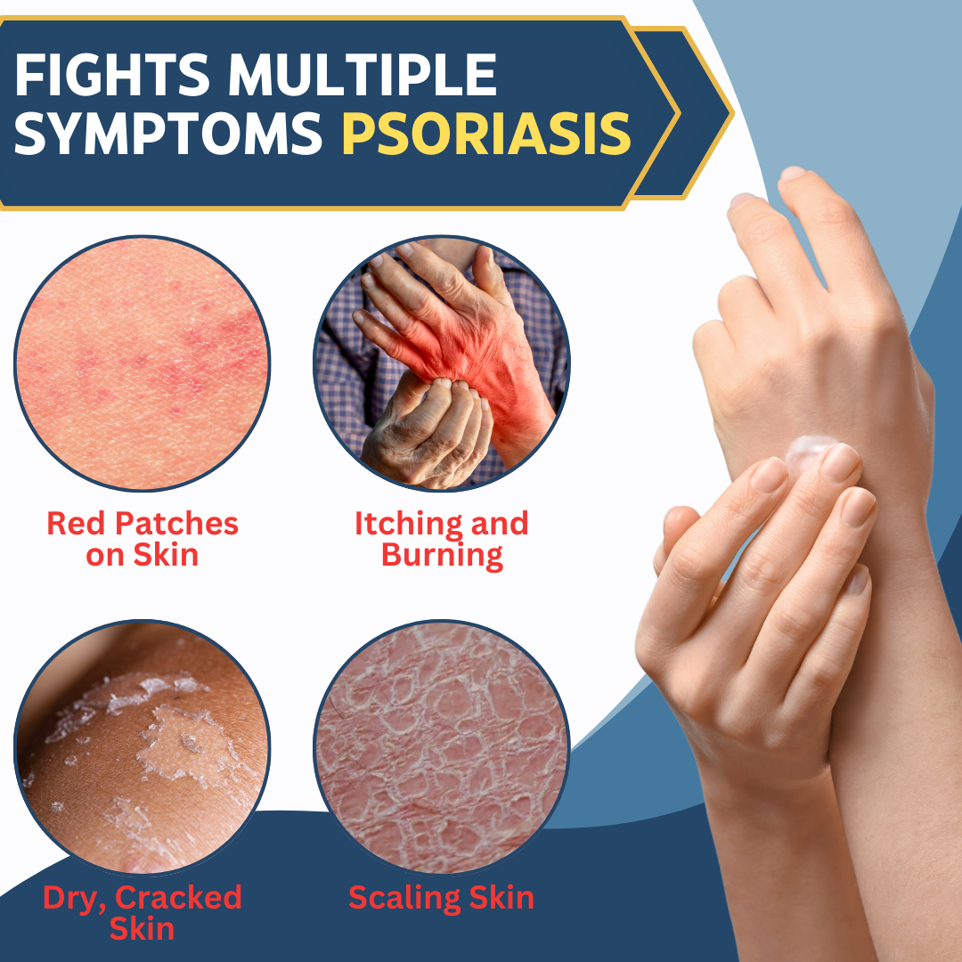 AEXZR™ Multi-Symptom Psoriasis Cream