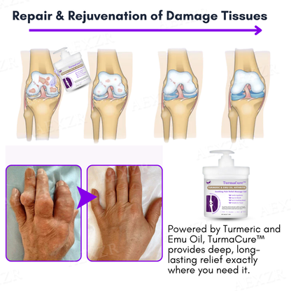 TurmaCure™ Turmeric & Emu Oil Arthritis Soothing Pain Relief Massage Gel