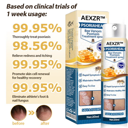 AEXZR™ PsoriaHeal Bee Venom Psoriasis Treatment Spray 🔥 Last Day Sale Off 80%🔥