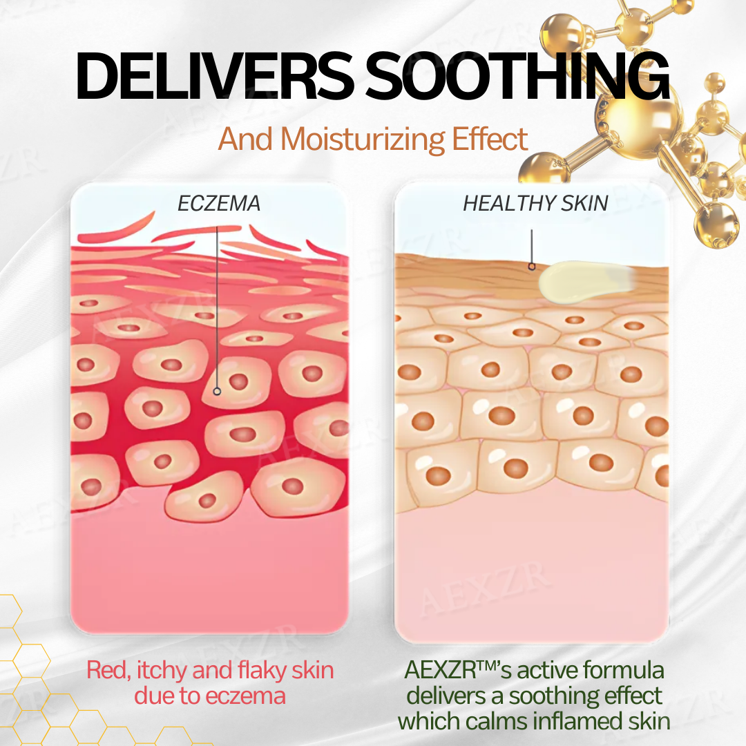 AEXZR™ New Zealand Manuka Honey Eczema Treatment Cream