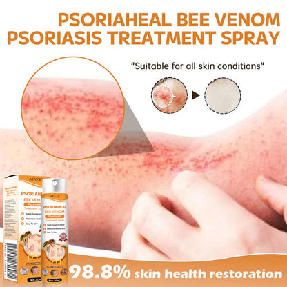 AEXZR™ PsoriaHeal Bee Venom Psoriasis Treatment Spray 💥Get Instant Relief💥