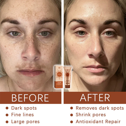 AEXZR® Herbal Spots Peel-Off Facial Mask
