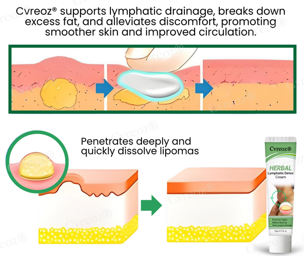 Cvreoz® Herbal Lymphatic Detox Cream 15 Cvreoz® Herbal Lymphatic Detox Cream